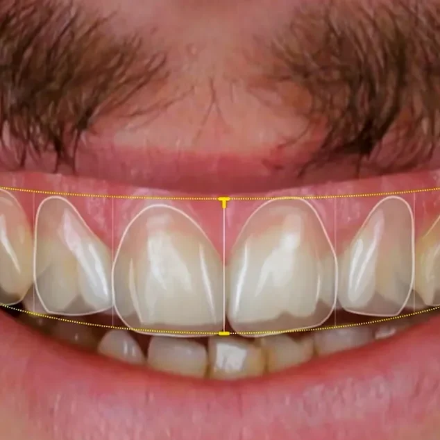 الذكاء الاصطناعي و عالم طب الأسنان وجراحات الفم